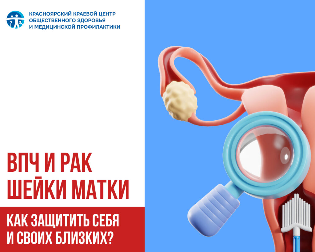 ВПЧ и рак шейки матки