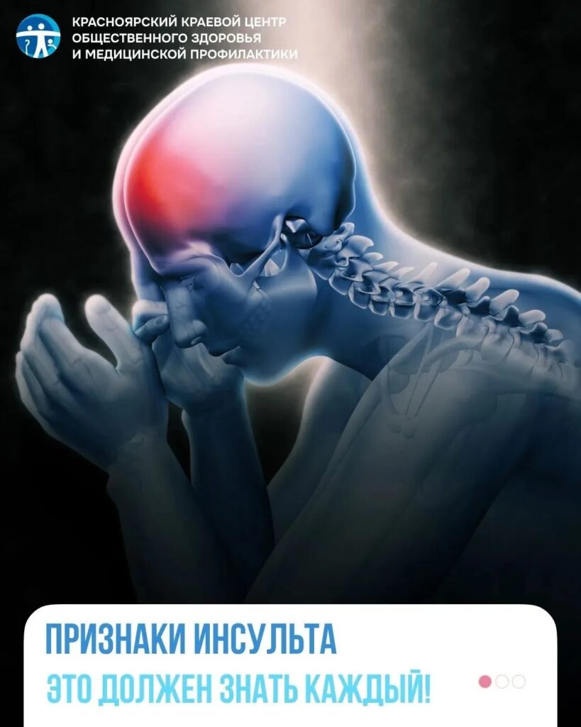 Признаки инсульта: нужно знать каждому